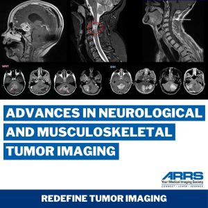 Advances in Neurological and Musculoskeletal Tumor Imaging