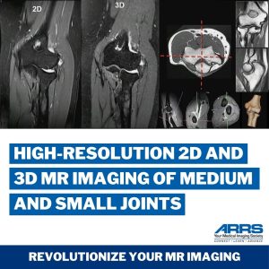 High Resolution 2D and 3D MR Imaging of Medium and Small Joints