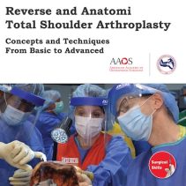 Reverse and Anatomic Total Shoulder Arthroplasty