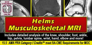 private helms musculoskeletal mri 2021 cme videos 63cb7713658ee