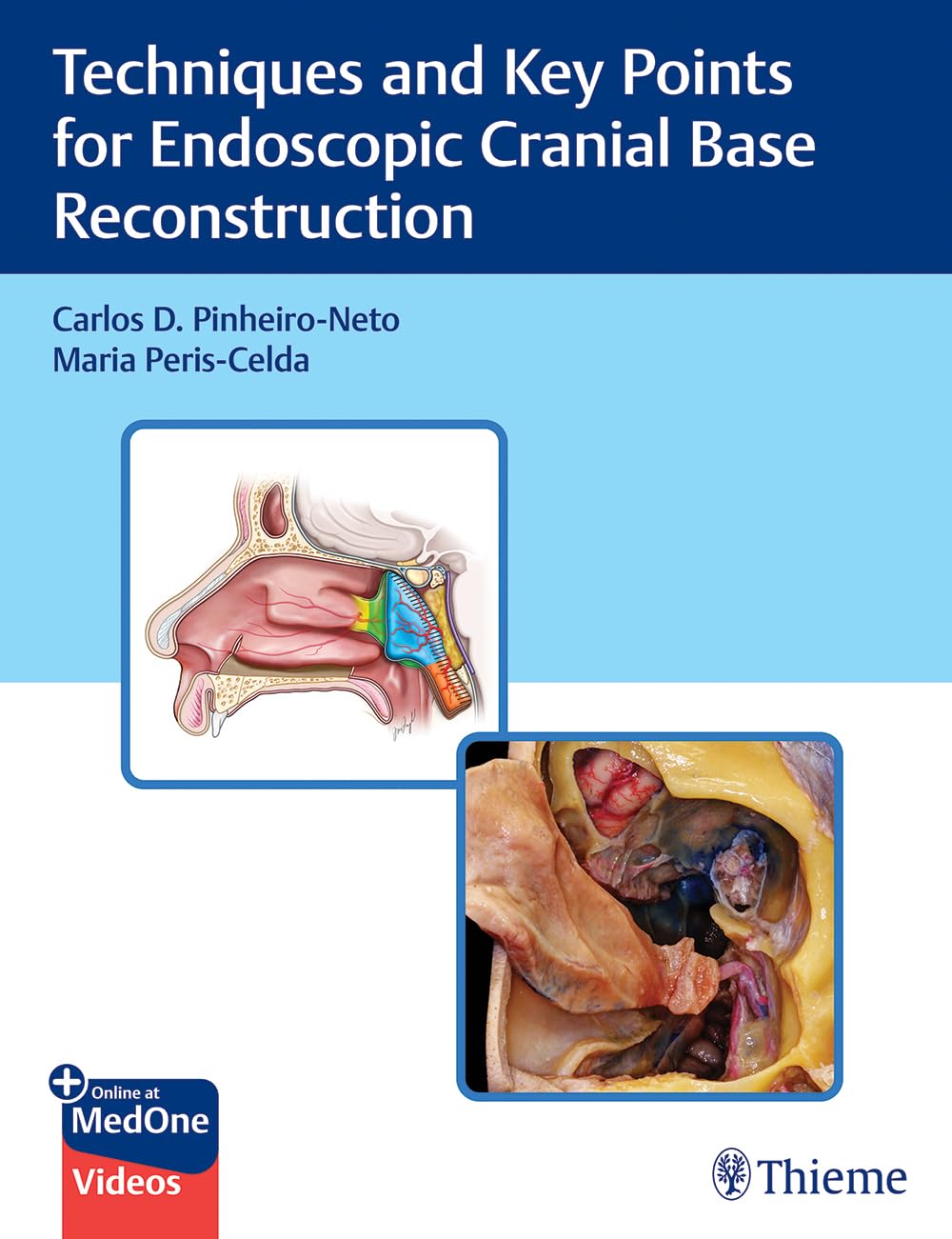 Techniques and Key Points for Endoscopic Cranial Base Reconstruction With Videos