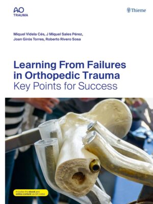 Learning From Failures in Orthopedic Trauma: Key Points for Success