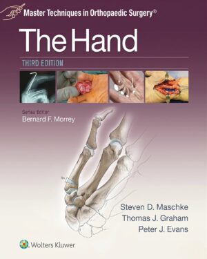 Master Techniques in Orthopaedic Surgery: The Hand