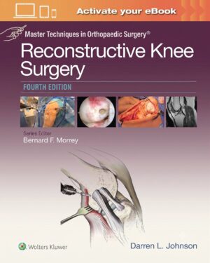 Master Techniques in Orthopaedic Surgery: Reconstructive Knee Surgery Fourth Edition