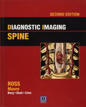 Diagnostic Imaging: Spine 2nd Edition