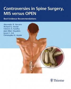 Controversies in Spine Surgery, MIS versus OPEN: Best Evidence Recommendations