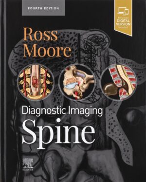 Diagnostic Imaging Spine