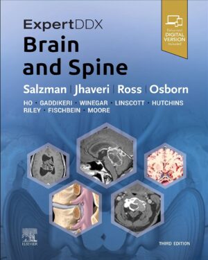 ExpertDDx: Brain and Spine 3rd Edition
