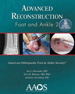 Advanced Reconstruction: Foot and Ankle 2: Print + eBook