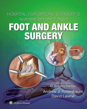Hospital for Special Surgery's Illustrated Tips and Tricks in Foot and Ankle Surgery 1st Edition, Kindle Edition