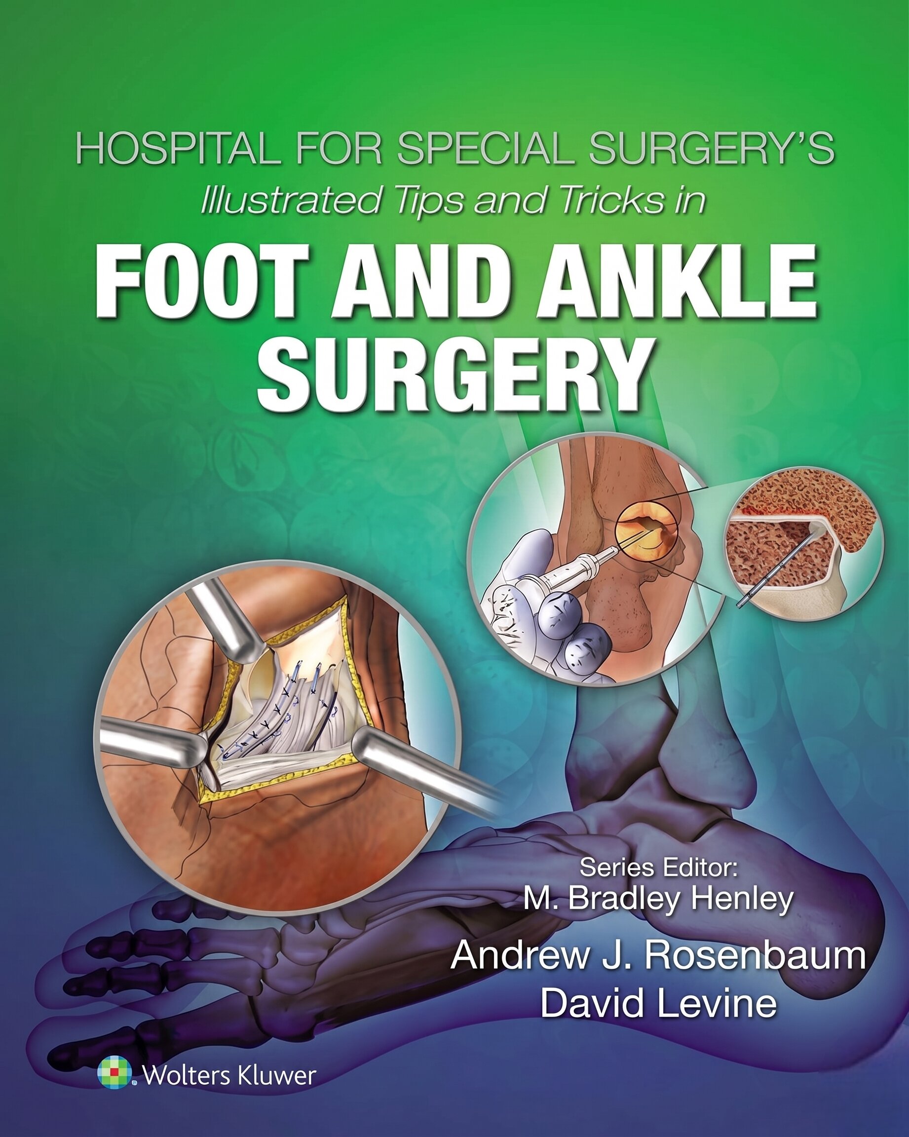 Hospital for Special Surgery's Illustrated Tips and Tricks in Foot and Ankle Surgery 1st Edition, Kindle Edition