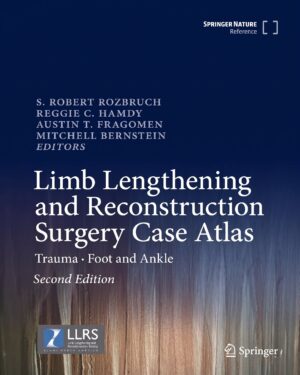 Limb Lengthening and Reconstruction Surgery Case Atlas: Trauma • Foot and Ankle 2nd Edition, Kindle Edition