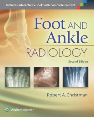 Foot and Ankle Radiology