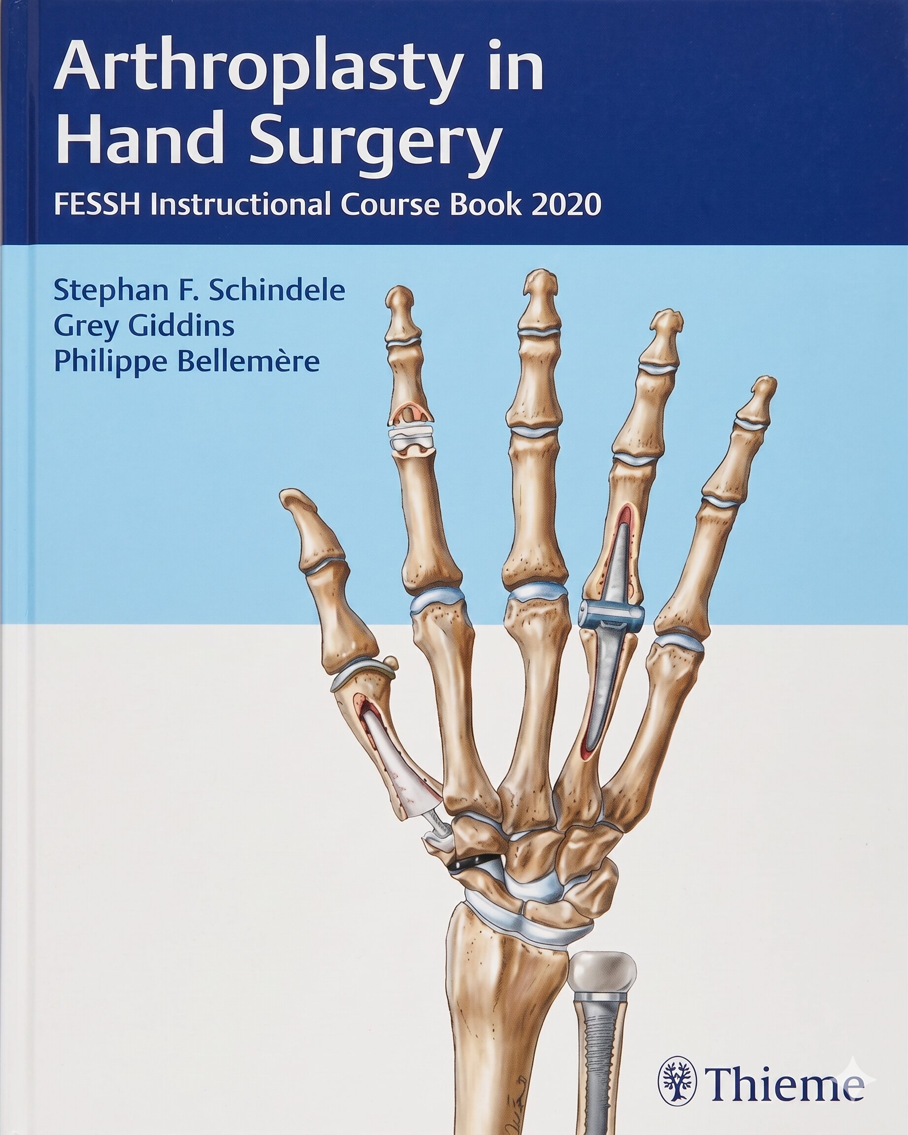 Arthroplasty in Hand Surgery: FESSH Instructional Course Book
