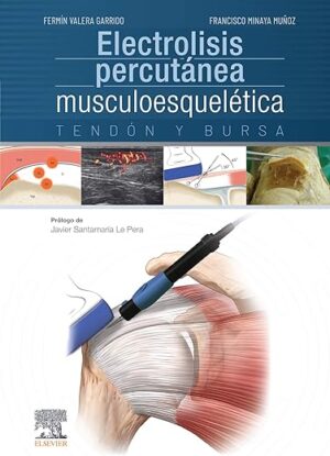 Electrolisis percutánea musculoesquelética (Spanish Edition)
