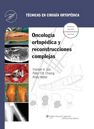 Técnicas en cirugía ortopédica. Oncología ortopédica y reconstrucciones complejas (Spanish Edition)